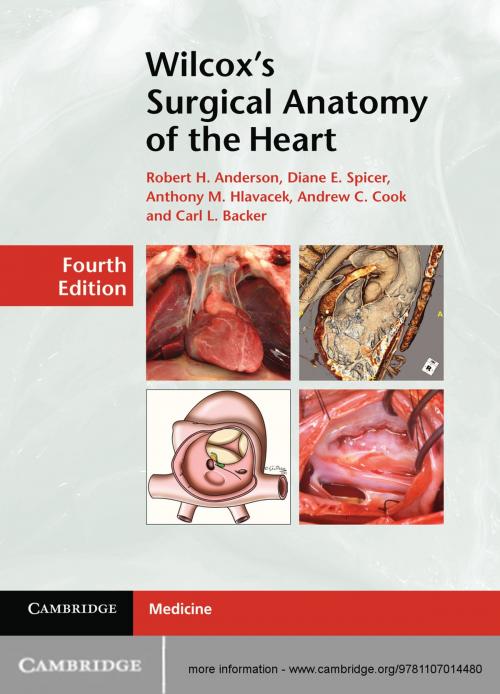 Cover of the book Wilcox's Surgical Anatomy of the Heart by Robert H. Anderson, Diane E. Spicer, Anthony M. Hlavacek, Andrew C. Cook, Carl L. Backer, Cambridge University Press