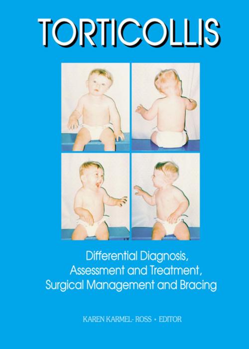 Cover of the book Torticollis by Karen Karmel-Ross, Taylor and Francis