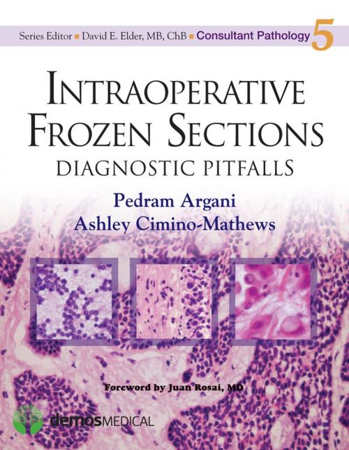 Cover of the book Intraoperative Frozen Sections by Pedram Argani, MD, Ashley Cimino-Mathews, MD, Springer Publishing Company