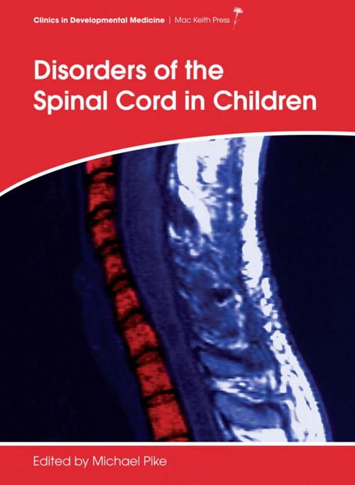 Cover of the book Disorders of the Spinal Cord in Children by , Mac Keith Press