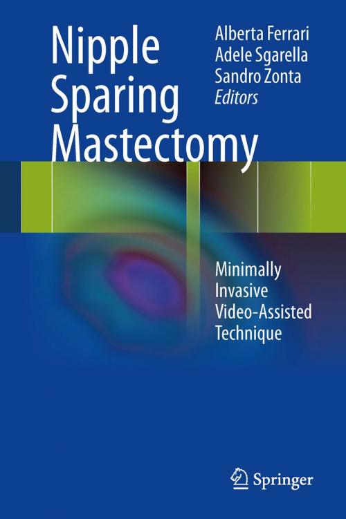 Cover of the book Nipple Sparing Mastectomy by , Springer Milan