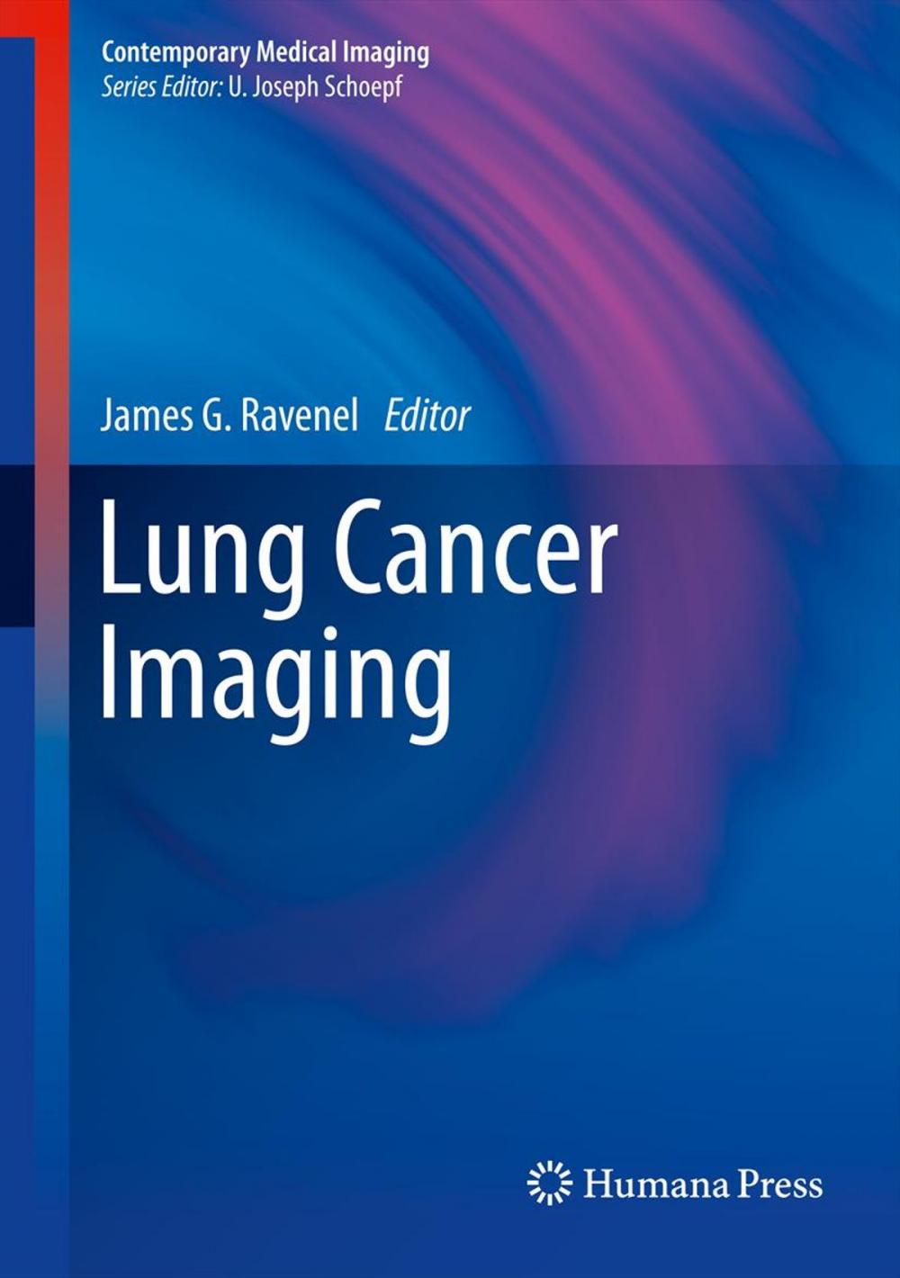 Big bigCover of Lung Cancer Imaging