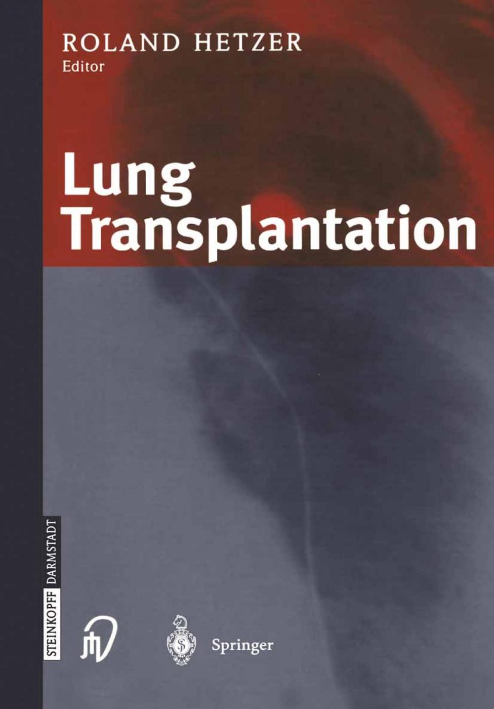 Big bigCover of Lung Transplantation