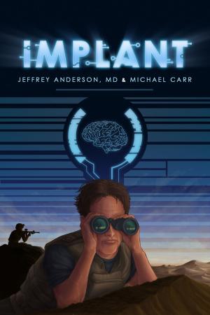 Cover of the book Implant by Brian K. Carr