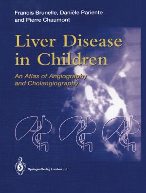 Book cover of Liver Disease in Children