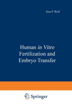 Cover of the book Human in Vitro Fertilization and Embryo Transfer by Jan D. Sinnott