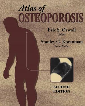 Cover of the book Atlas of Osteoporosis by Gene Hunder