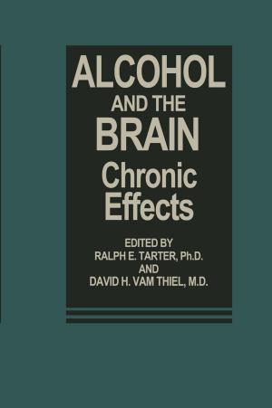 bigCover of the book Alcohol and the Brain by 