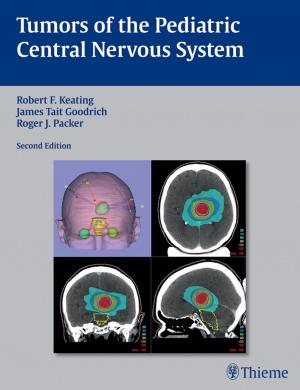 Cover of the book Tumors of the Pediatric Central Nervous System by Thom J. Zimmerman, Karanjit S. Kooner