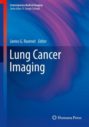 Cover of the book Lung Cancer Imaging by Clinton Jeffery, Jafar Al-Gharaibeh