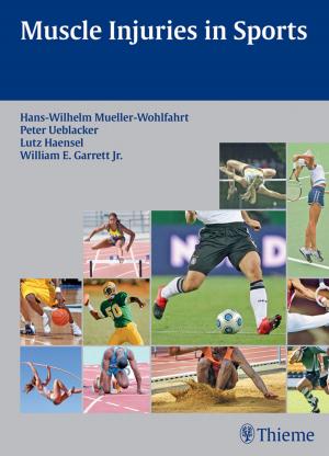 Cover of the book Muscle Injuries in Sports by Mahmut Gazi Yasargil
