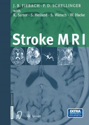 Cover of the book Stroke MRI by O. Sperling, W. Vahlensieck