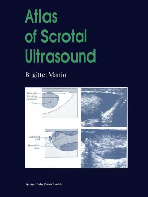 Book cover of Atlas of Scrotal Ultrasound