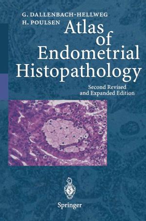 Cover of the book Atlas of Endometrial Histopathology by Martin W. Donner, J.H. Anderson, William R. Brody, S.J. Blackband, Friedrich Heuck, E.K. Fishman, J.D. Glickson, H.H. Holcomb, W.C. Hunter, J.E. Kuhlman, A.J. Kumar, F.P. Sr. Leo, H.L. Loats, K.I. Macrae, D. Magid, C.P. Martin, D.R. Ney, D.D. Robertson, A.E. Rosenbaum, S. Uematsu, J.P. Wehrle, D.F. Wong, E.A. Zerhouni