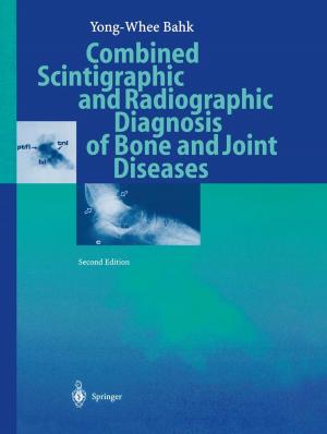 Cover of the book Combined Scintigraphic and Radiographic Diagnosis of Bone and Joint Diseases by Juan G. Roederer, Hui Zhang