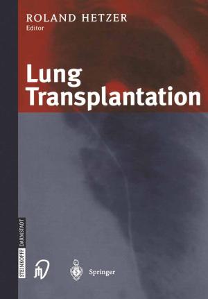 Cover of the book Lung Transplantation by H. Just, C. Holubarsch, H. Scholz