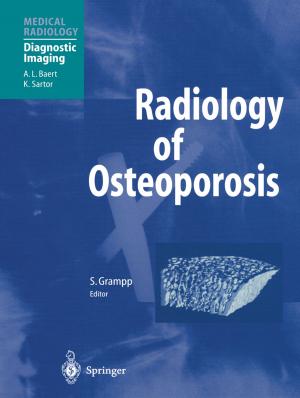 Cover of the book Radiology of Osteoporosis by Bharat Bhushan