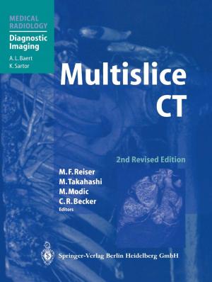 Cover of the book Multislice CT by R. Ackermann, K.-D. Bachmann, H. Behrendt, P.E. Billimoria, H.C. Dominick, M.D. Gross, R. Hartung, W. Havers, R. Heckemann, J.V. Kaude, R.E. Kinard, E.K. Lang, L.-D. Leder, E. Löhr, A.A. Moss, R.-D. Müller, H.J. Richter, E. Scherer, M. Serdarevic, B. Shapiro, W.P. Shuman, J.L. Williams, C. Wirtz