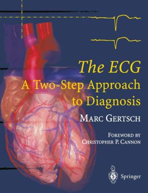 Cover of the book The ECG by P. Alken, D. Bach, C. Chaussy, R. Hautmann, F. Hering, W. Lutzeyer, M. Marberger, E. Schmied, H.-J. Schneider, W. Stackl