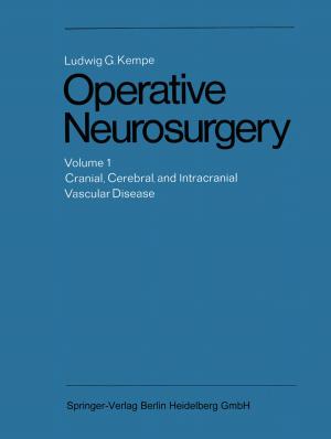 Cover of the book Operative Neurosurgery by Kampeng Lei, Shaoqi Zhou, Zhishi Wang