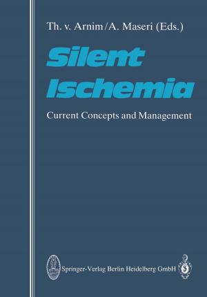 Cover of the book Silent Ischemia by Wolfram an der Heiden, Franz Resch, Johannes Schröder