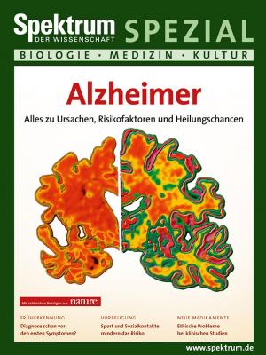 Cover of the book Alzheimer by 