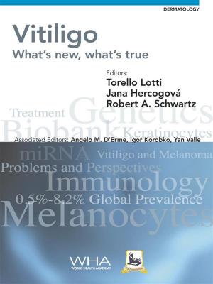 Cover of the book Vitiligo by Chase Andersson