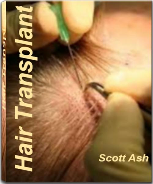 Cover of the book Hair Transplant by Scott Ash, JDSims Publishing