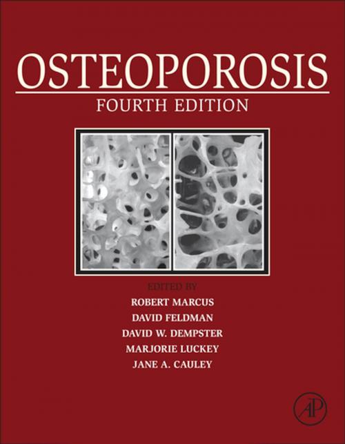 Cover of the book Osteoporosis by , Elsevier Science