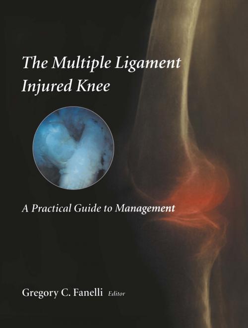Cover of the book The Multiple Ligament Injured Knee by , Springer New York