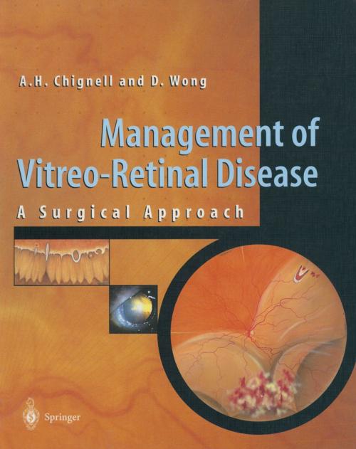 Cover of the book Management of Vitreo-Retinal Disease by Anthony Chignell, David Wong, Springer London