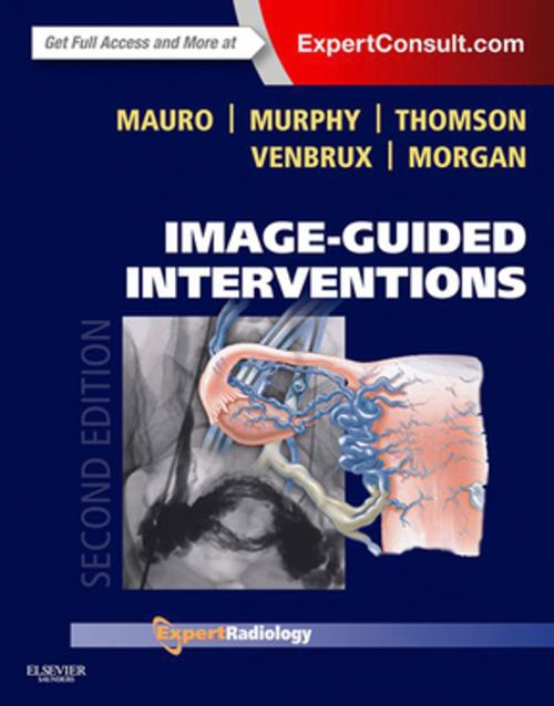 Cover of the book Image-Guided Interventions E-Book by Matthew A. Mauro, MD, FACR, Kieran P.J. Murphy, MB, FRCPC, FSIR, Kenneth R. Thomson, MD, FRANZCR, Anthony C. Venbrux, MD, Robert A. Morgan, MBChB, MRCP, FRCR, EBIR, Elsevier Health Sciences