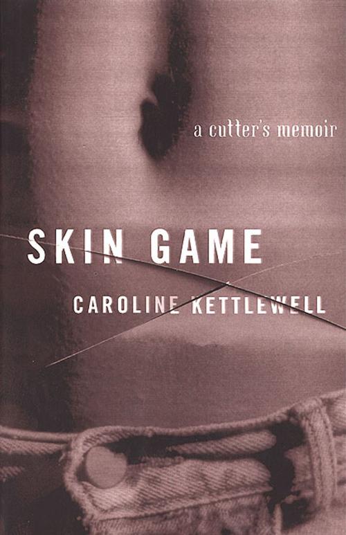 Cover of the book Skin Game by Caroline Kettlewell, St. Martin's Press