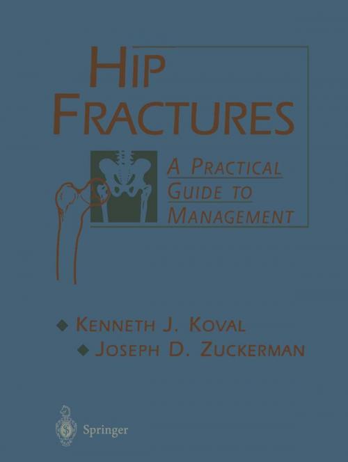 Cover of the book Hip Fractures by Kenneth Koval, Joseph Zuckerman, Springer New York