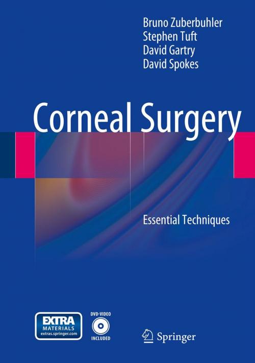 Cover of the book Corneal Surgery by Bruno Zuberbuhler, Stephen Tuft, David Gartry, David Spokes, Springer Berlin Heidelberg