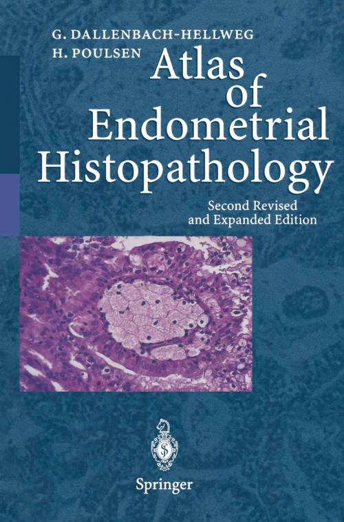 Cover of the book Atlas of Endometrial Histopathology by Gisela Dallenbach-Hellweg, Hemming Poulsen, Springer Berlin Heidelberg