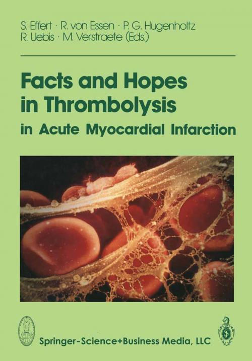Cover of the book Facts and Hopes in Thrombolysis in Acute Myocardial Infarction by , Steinkopff