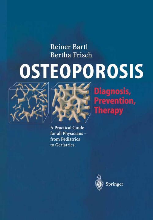 Cover of the book OSTEOPOROSIS by Reiner Bartl, Christoph Bartl, Bertha Frisch, Springer Berlin Heidelberg