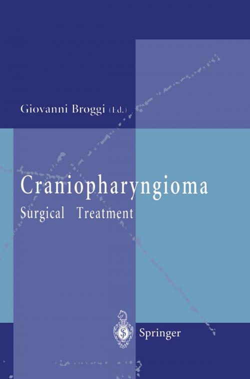 Cover of the book Craniopharyngioma by , Springer Milan