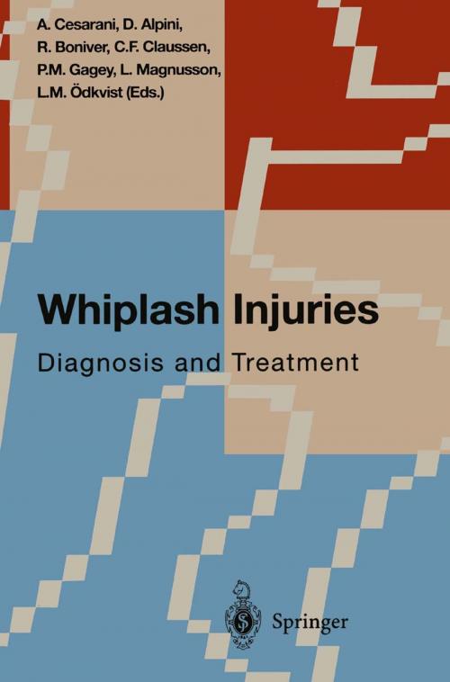 Cover of the book Whiplash Injuries by A. Cesarani, R. Boniver, C.F. Claussen, L. Magnusson, L.M. Ödkvist, Dario Alpini, P.M. Gagey, Springer Milan