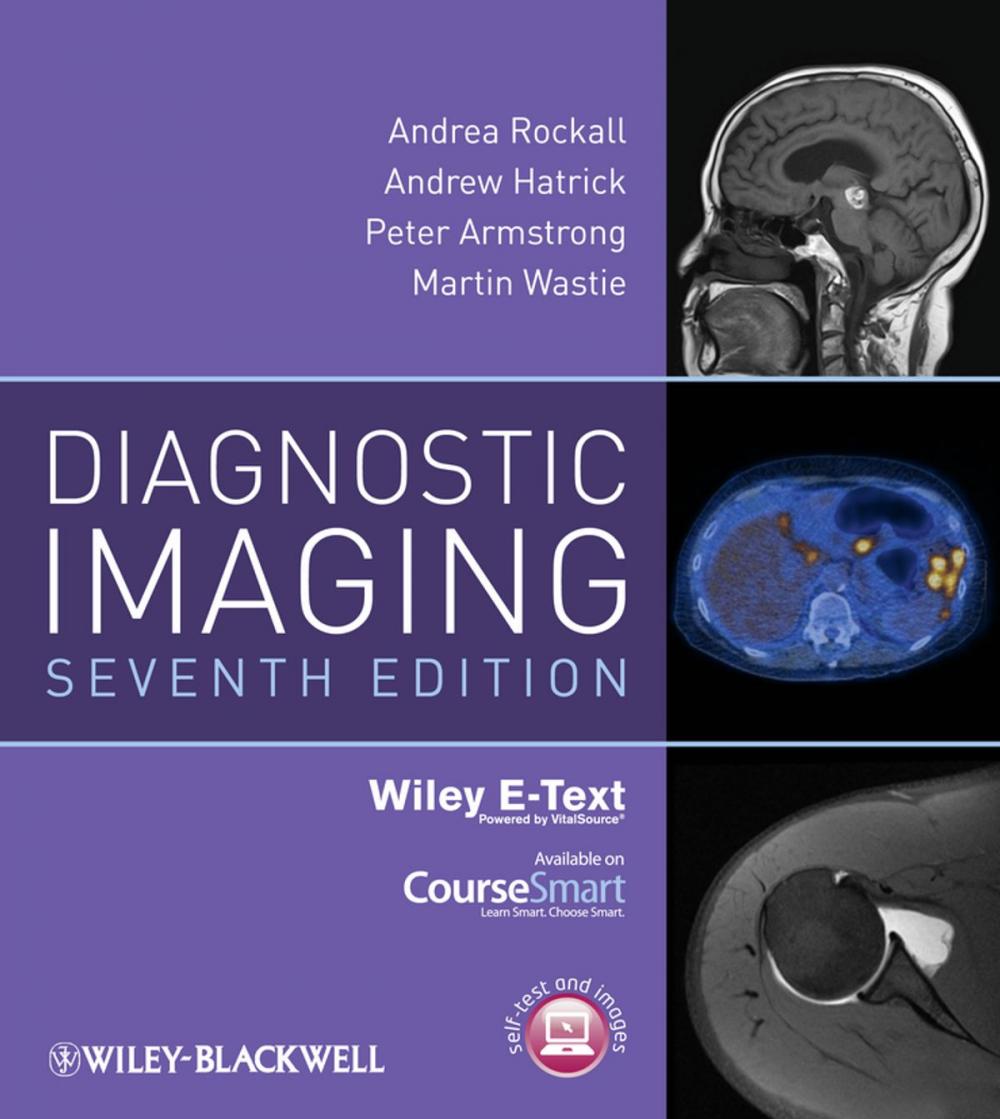 Big bigCover of Diagnostic Imaging