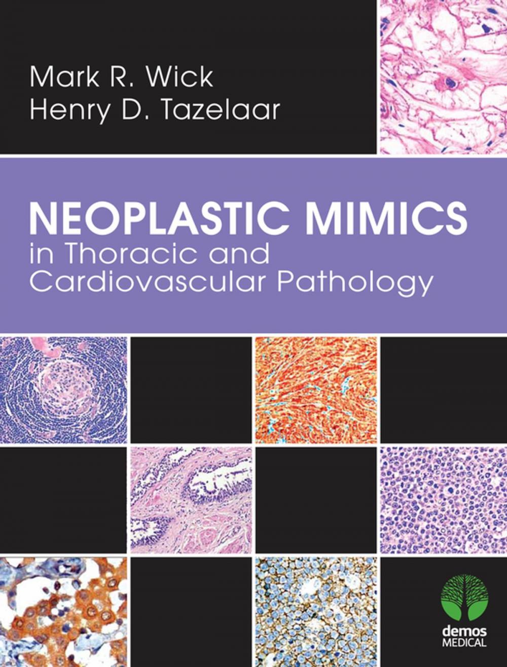 Big bigCover of Neoplastic Mimics in Thoracic and Cardiovascular Pathology