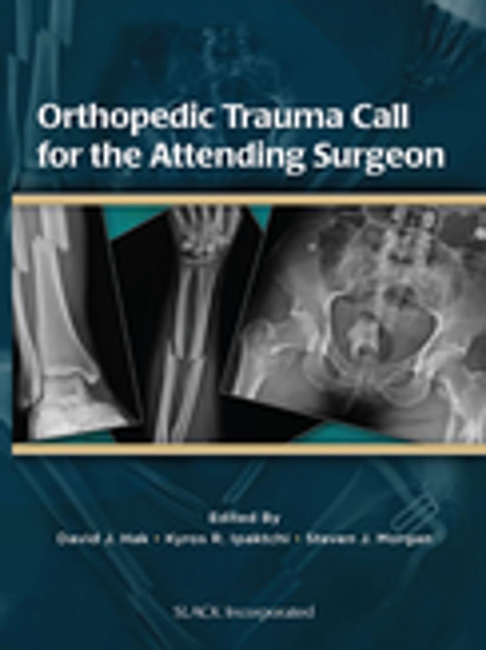 Big bigCover of Orthopedic Trauma Call for the Attending Surgeon