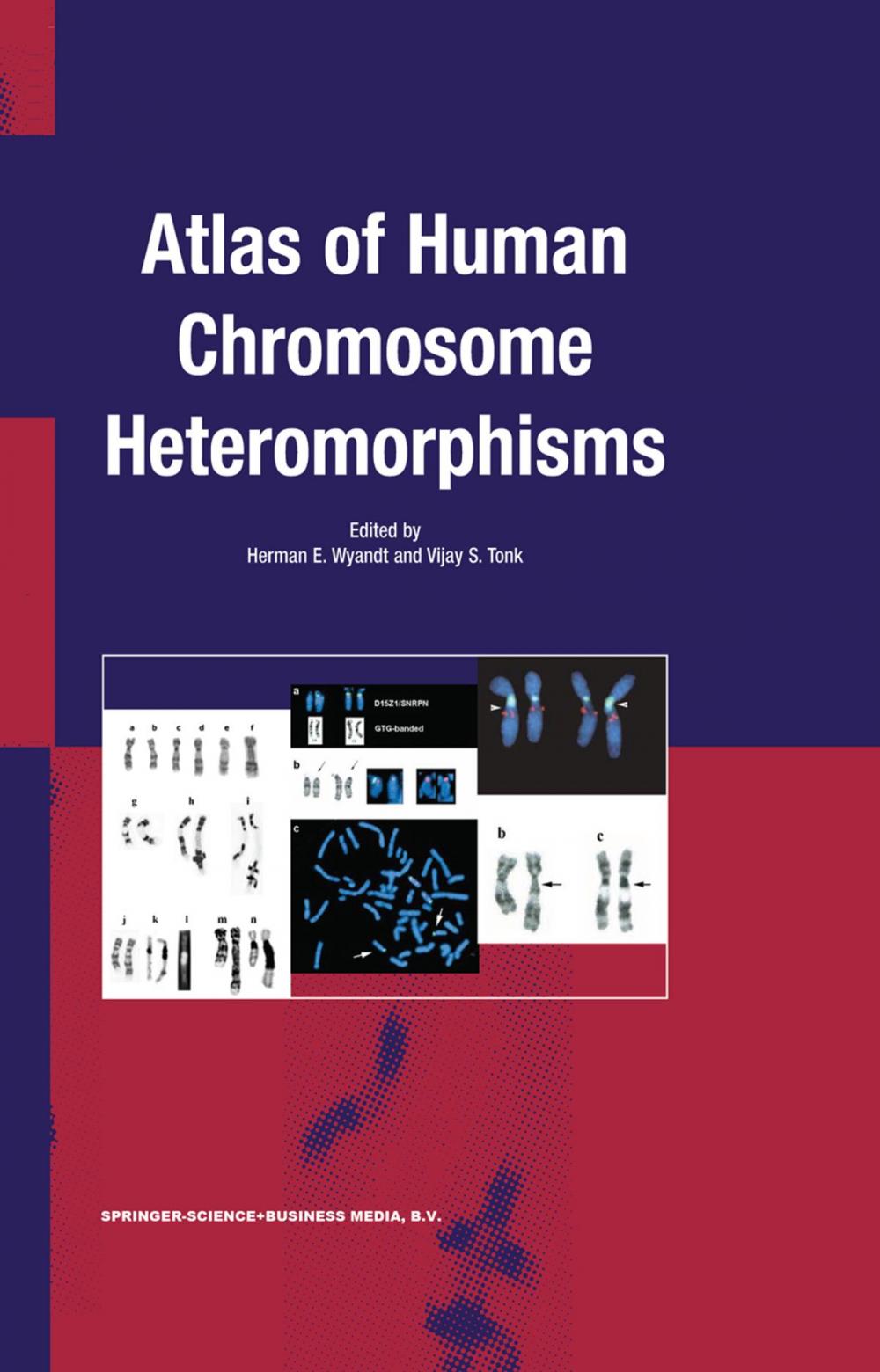 Big bigCover of Atlas of Human Chromosome Heteromorphisms