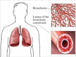 bigCover of the book Aspergillosis: Causes, Symptoms and Treatments by 