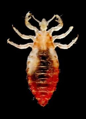 bigCover of the book Body Lice: Causes, Symptoms and Treatments by 