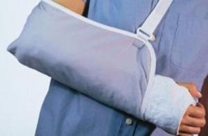 Cover of Broken Arm: Causes, Symptoms and Treatments
