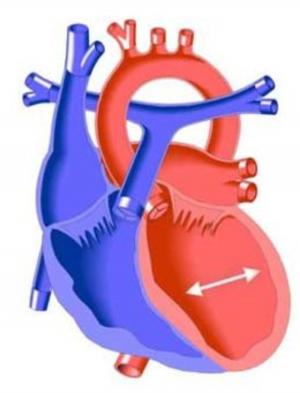 Cover of Cardiomyopathy: Causes, Symptoms and Treatments