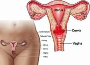 Book cover of Cervicitis: Causes, Symptoms and Treatments