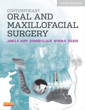 Book cover of Contemporary Oral and Maxillofacial Surgery - E-Book